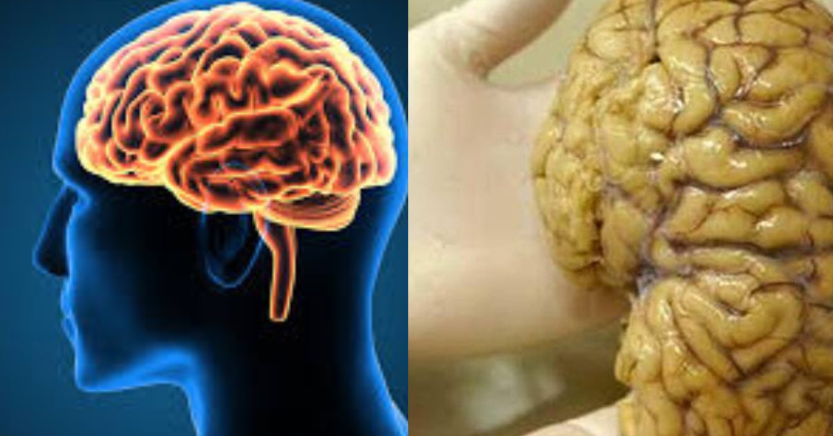 மூளையை உண்ணும் அமீபா வைரஸ் Brain Virus சிறுவர்களுக்கான அறிவுத்திறன்
